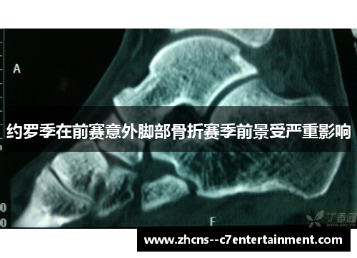 约罗季在前赛意外脚部骨折赛季前景受严重影响 约罗季在前赛意外脚部骨折赛季前景受严重影响